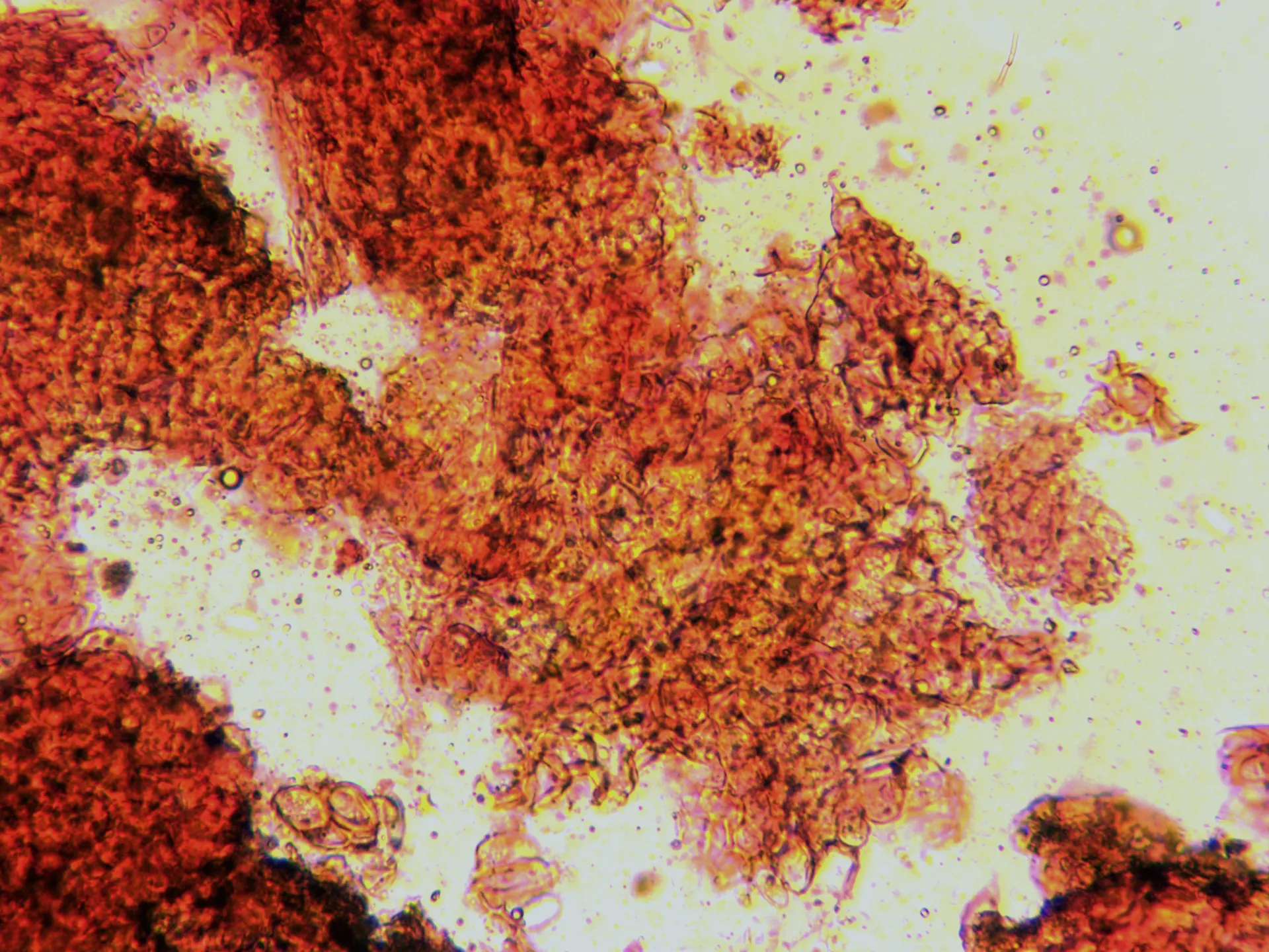Microscopía de Thyronectria sinopica - 14 - Peritecio x 400